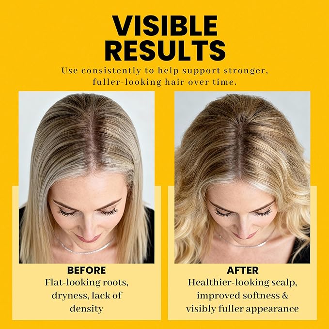 Herbishh Rosemary Hair Essence Oil (50 ml) With Peppermint & Lavender – Growth Oil for Hair Thickening, Dry Scalp Treatment, Helps Support Regrowth & Reduce Breakage, For Men & Women