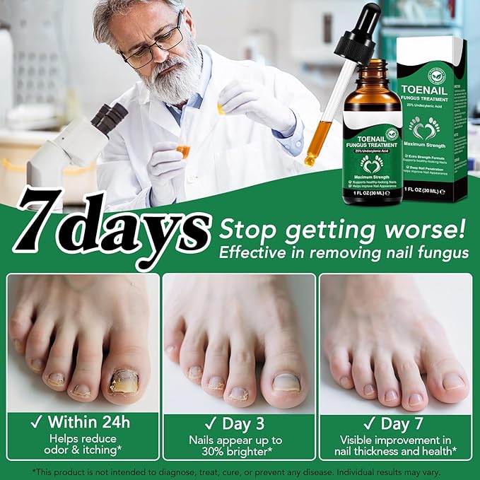 Toenail Treatment with 25% Undecylenic Acid, Nail Renewal, Promotes Nails Health,Enrich Jojoba Oil and Vitamin E Nourish Nail & Skin,Safe & Gentle Repairing Damaged Nails