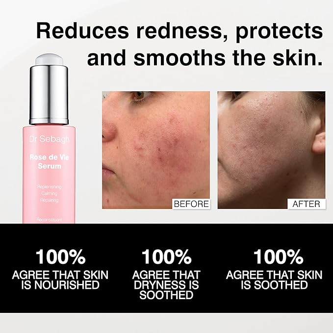 Dr Sebagh Rose de Vie Serum - 1 fl oz - Award-Winning Nourishing Anti-Aging Formula - Use with Dry, Mature, or Sensitive Skin - Designed to Soothe Redness & Irritation - Regenerating & Invigorating