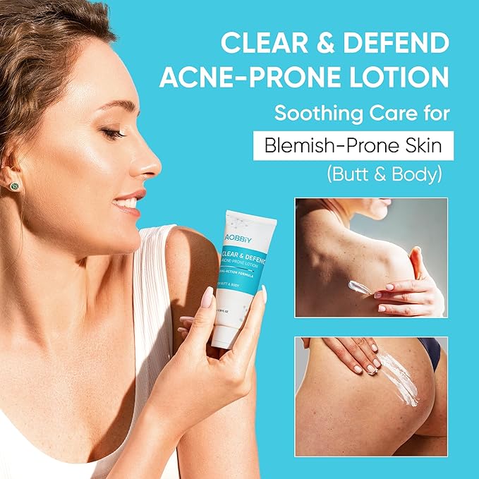 Butt Acne Clearing Treatment Cream: Clears & Prevents Breakouts Fast – Gentle Body & Back Lotion for Clogged Pores, Folliculitis & Bumps, 2% Salicylic Acid & Niacinamide, Ideal for Women, Men & Teens