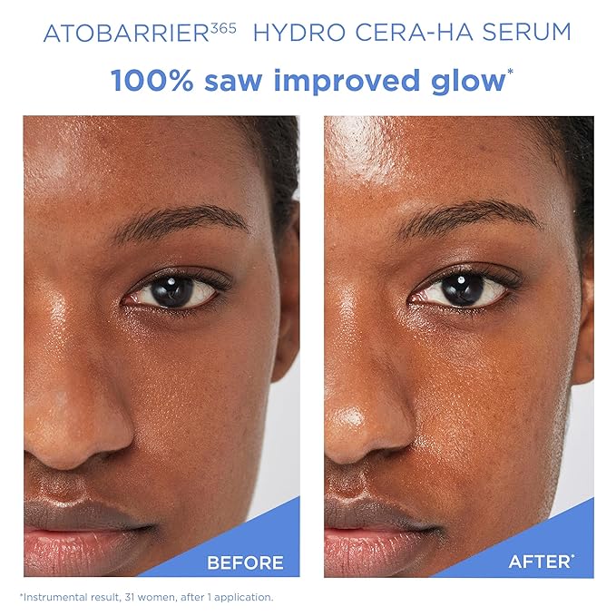 AESTURA ATOBARRIER365 Hydro CERA-HA Face Serum with Ceramide, Hyaluronic Acid, and Niacinamide for Skin Moisture Barrier Repair | Deep Hydration, Suitable for Dry & Sensitive Skin, 30ML / 1.01 fl.oz.