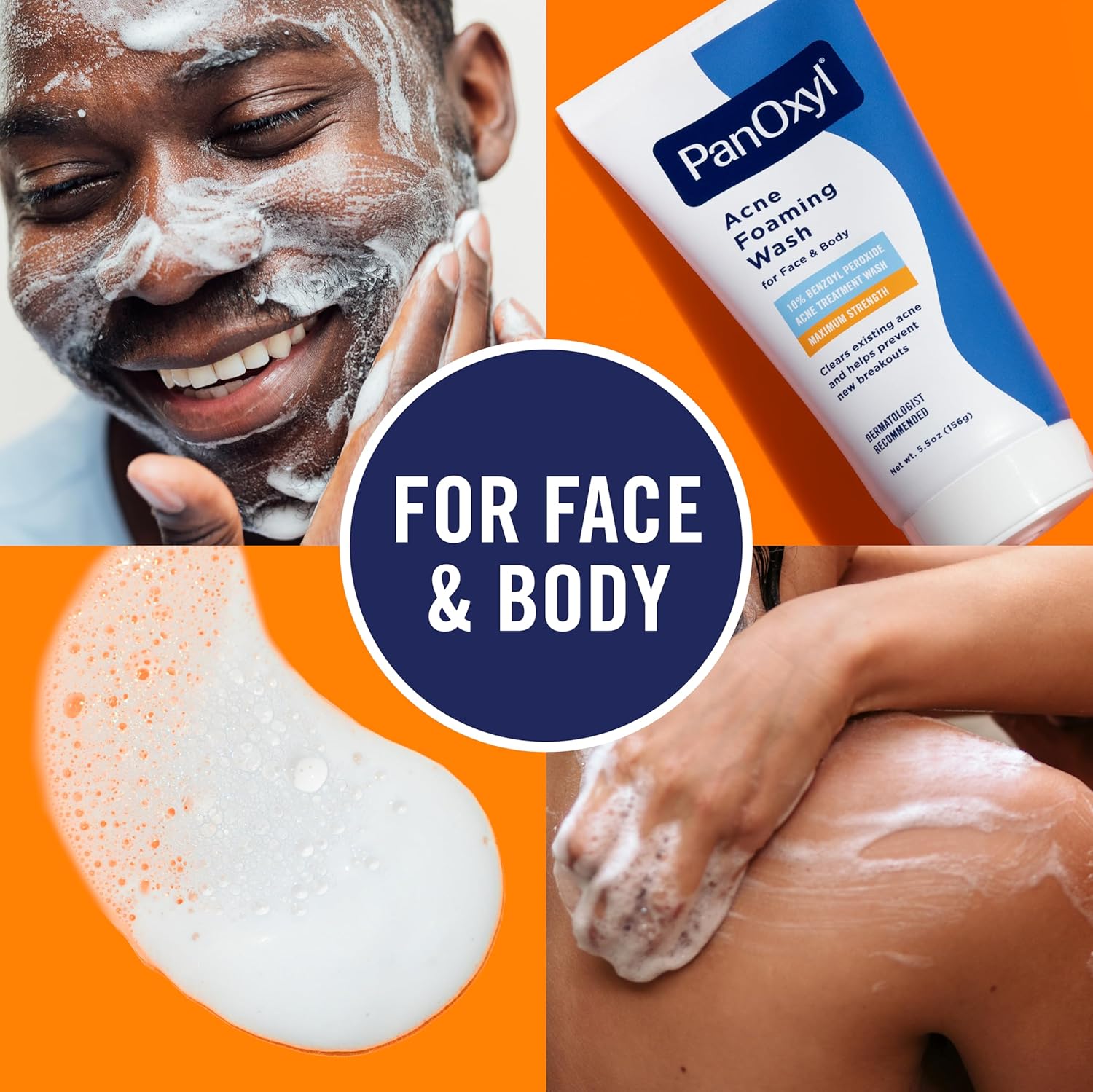 10% Benzoyl Peroxide Acne Foaming Wash, Maximum Strength, Daily Acne-Fighting Face and Body Cleanser, Face Wash to Clear, Treat and Prevent Acne Pimples and Stubborn Breakouts, 5.5 Oz Tube