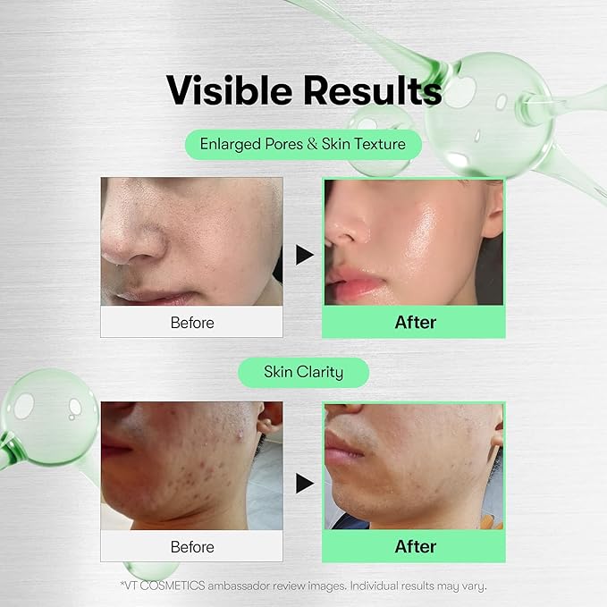 VT COSMETICS Reedle Shot 100 & PDRN Essence Set, Microneedling Serum and Glow Serum Duo for Glass Skin, Korean Skincare