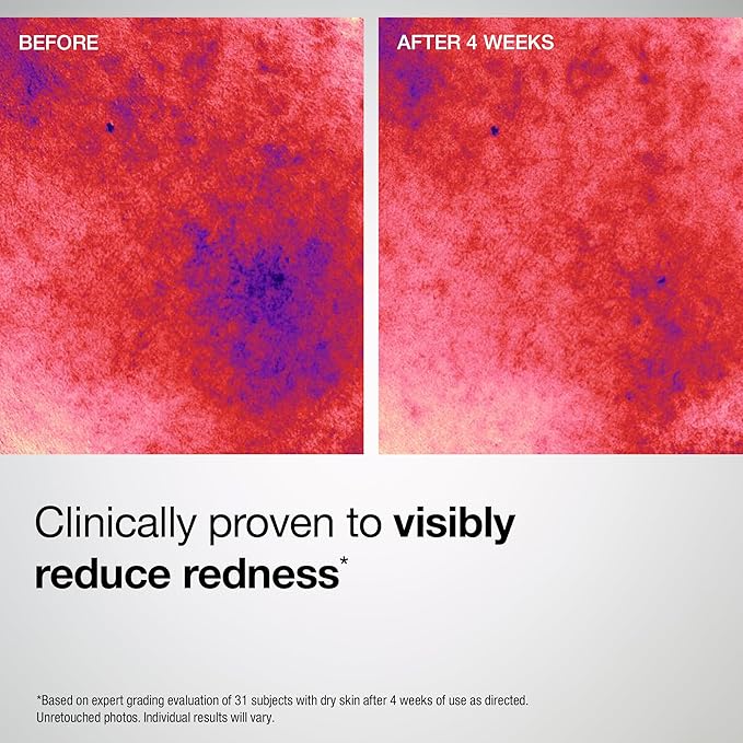 StriVectin Barrier Restore + Soothing Ceramide Cream with Ceramides + Niacinamide, Hydrating & Soothing, Fragrance‑Free, Turmeric, Face & Neck Moisturizer