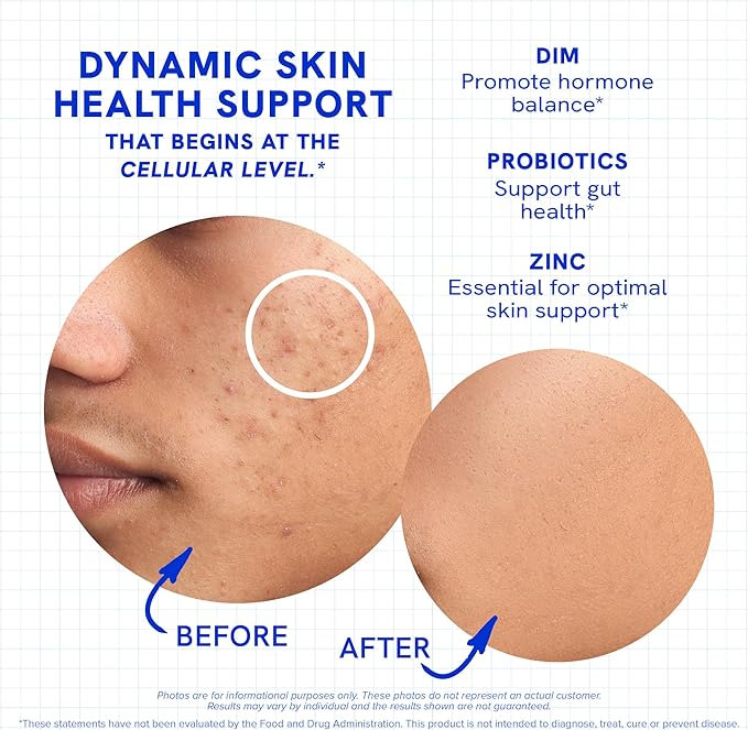 Clear Skin Supplement with Zinc, DIM & Probiotics | 3-in-1 Balance, Glow & Health Skin Support | Triple Action Hyaluronic Acid, Niaciminide & Vitamins for Hormone, Complexion & Gut Support | 180 Ct