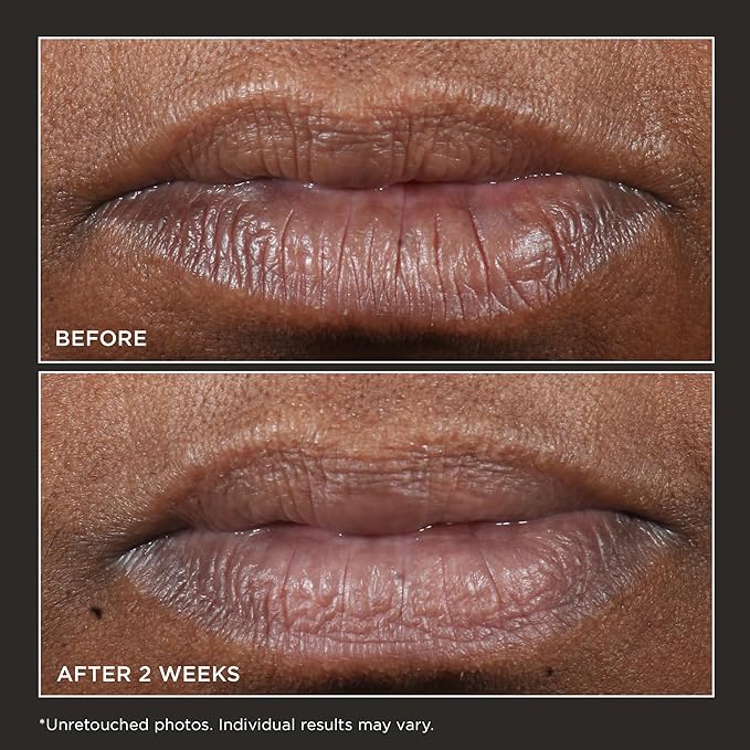 Perricone MD Cold Plasma Plus+ Lip Therapy