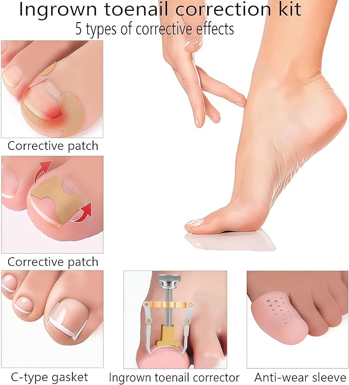 Professional ingrown toenail Correction kit with Travel Storage Box, Pedicure Tools, ingrown toenail Patches, Nail Clippers, and Nail File for Convenient at-Home Foot Care.