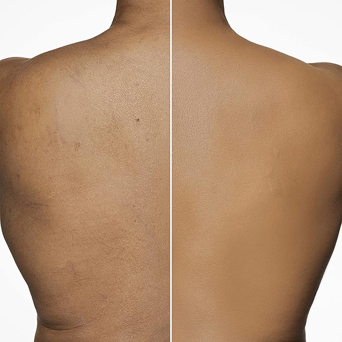 Dermablend Leg and Body Makeup Foundation with SPF 25, 0N Fair Nude, 3.4 Fl. Oz.