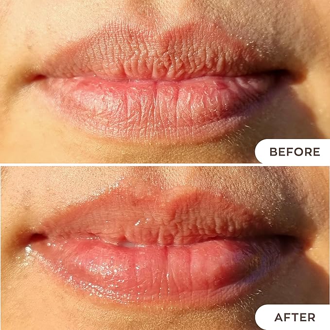 Hanalei Lip Treatment for Dry, Chapped Lips – Intensive Overnight Moisturizer with Kukui Oil, Shea Butter & Grapeseed Oil – Hydrating Balm for Healing Cracks – Rose Pink Tint, 15g – Cruelty-Free